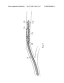 Steerable Endovascular Retrieval Device diagram and image