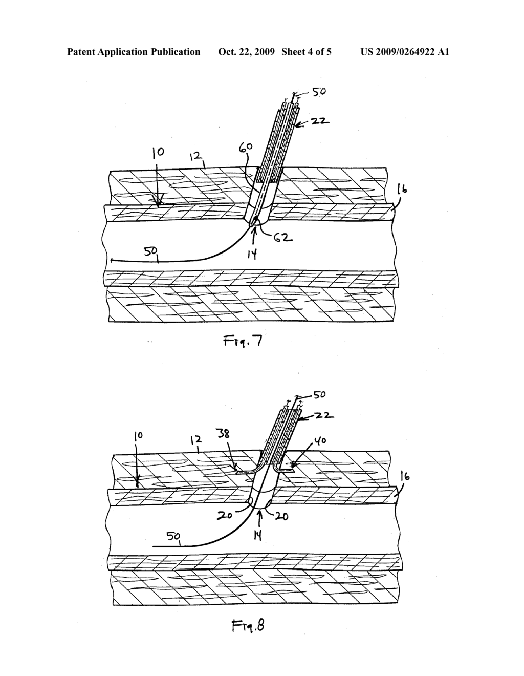 Device and Method for Effecting Hemostasis about a Blood Vessel Puncture - diagram, schematic, and image 05