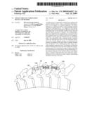 Spinous process stabilization device and method diagram and image