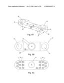 Spinous process stabilization device and method diagram and image