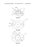 Spinous process stabilization device and method diagram and image