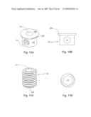 Spinous process stabilization device and method diagram and image