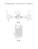 Spinous process stabilization device and method diagram and image