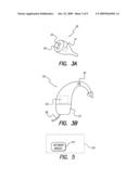 Electric and Acoustic Stimulation Fitting Systems and Methods diagram and image