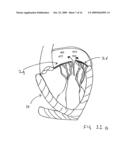 TRANSVALVULAR INTRAANNULAR BAND FOR VALVE REPAIR diagram and image