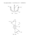 TRANSVALVULAR INTRAANNULAR BAND FOR VALVE REPAIR diagram and image