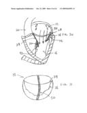 TRANSVALVULAR INTRAANNULAR BAND FOR VALVE REPAIR diagram and image