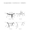 TRANSVALVULAR INTRAANNULAR BAND FOR VALVE REPAIR diagram and image