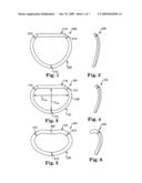 Set of Annuloplasty Devices with Varying Anterior-Posterior Ratios and Related Methods diagram and image