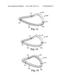 Set of Annuloplasty Devices with Varying Anterior-Posterior Ratios and Related Methods diagram and image