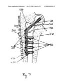 MATERIAL FOR SURGICAL USE IN TRAUMATOLOGY diagram and image