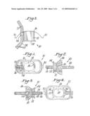 ENDOSCOPIC BITE BLOCK diagram and image