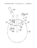 ENDOSCOPIC BITE BLOCK diagram and image