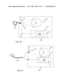 AUGMENTED STEREOSCOPIC VISUALIZATION FOR A SURGICAL ROBOT diagram and image