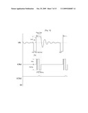 CIRCUIT FOR OUTPUT VOLTAGE ERROR DETECT AND FEEDBACK IN SMPS diagram and image