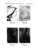 Methods for Using a Three-Dimensional Stromal Tissue to Promote Angiogenesis diagram and image