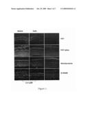 Inhibition of Neovascularization by Cerium Oxide Nanoparticles diagram and image