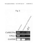 Composition and method for diagnosing esophageal cancer and metastasis of esophageal cancer diagram and image