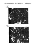 METHOD OF INHIBITING ANGIOGENESIS BY USING EPHRIN B2 diagram and image