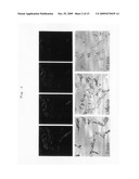 Prophylactic/therapeutic agent for alzheimer s disease diagram and image