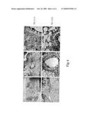 USE OF THYMOSIN ALPHA 1 FOR THE PREPARATION OF A MEDICAMENT FOR THE PREVENTION AND TREATMENT OF ALLERGIES diagram and image