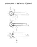 SCRAPING FLUID REMOVAL IN A SURGICAL ACCESS DEVICE diagram and image