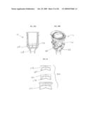 SCRAPING FLUID REMOVAL IN A SURGICAL ACCESS DEVICE diagram and image