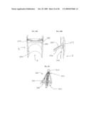 SCRAPING FLUID REMOVAL IN A SURGICAL ACCESS DEVICE diagram and image