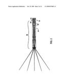 ENDOSCOPE diagram and image