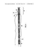 ENDOSCOPE diagram and image