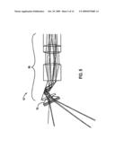 ENDOSCOPE diagram and image