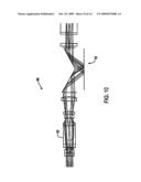 ENDOSCOPE diagram and image