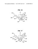 METHODS AND DEVICES FOR MAINTAINING VISIBILITY DURING SURGICAL PROCEDURES diagram and image