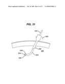 METHODS AND DEVICES FOR MAINTAINING VISIBILITY DURING SURGICAL PROCEDURES diagram and image