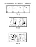 MARGIN DETERMINATION/TUMOR CELL MIGRATION diagram and image