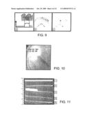 MARGIN DETERMINATION/TUMOR CELL MIGRATION diagram and image