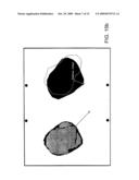 MARGIN DETERMINATION/TUMOR CELL MIGRATION diagram and image