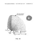 MARGIN DETERMINATION/TUMOR CELL MIGRATION diagram and image