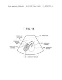 ULTRASONIC IMAGING APPARATUS AND METHOD diagram and image