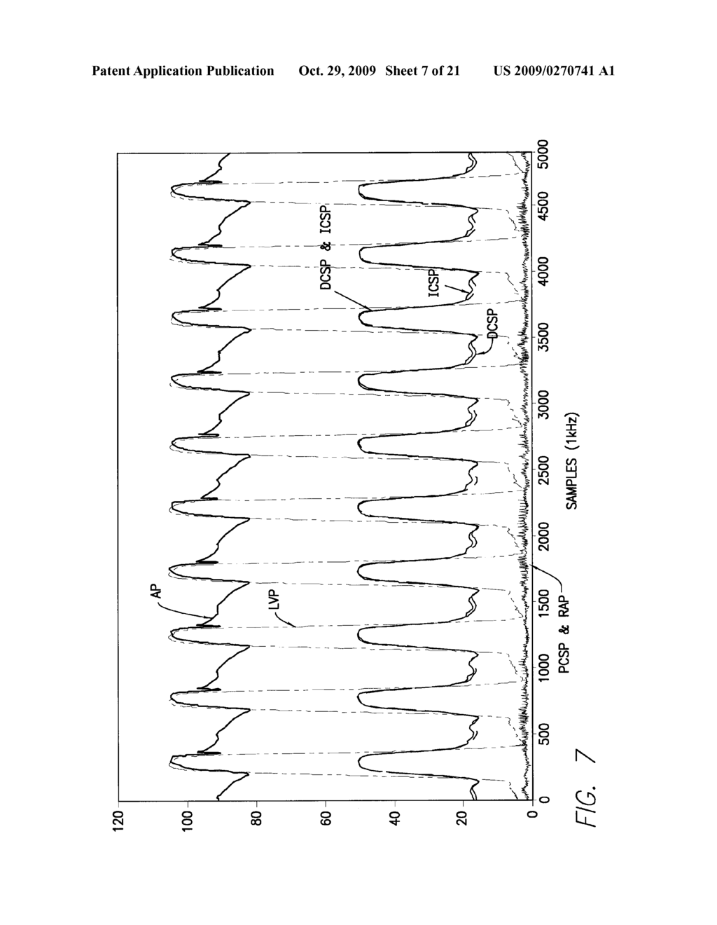 Coronary Venous System Pressure Sensing - diagram, schematic, and image 08