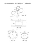 DEVICES FOR FIXING A SENSOR IN A LUMEN diagram and image