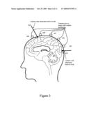 Device, methods, and control for sonic guidance of molecules and other material utilizing time-reversal acoustics diagram and image