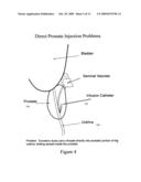 Device, methods, and control for sonic guidance of molecules and other material utilizing time-reversal acoustics diagram and image