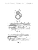 Aspiration Catheter Having An Internal Vacuum Accumulator diagram and image