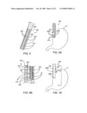 APPARATUS AND METHODS FOR PERFORMING MUCOSECTOMY diagram and image