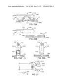 APPARATUS AND METHODS FOR PERFORMING MUCOSECTOMY diagram and image