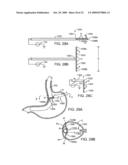 APPARATUS AND METHODS FOR PERFORMING MUCOSECTOMY diagram and image