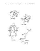 APPARATUS AND METHODS FOR PERFORMING MUCOSECTOMY diagram and image