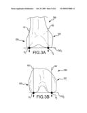 GENERATION OF A COMPUTERIZED BONE MODEL REPRESENTATIVE OF A PRE-DEGENERATED STATE AND USEABLE IN THE DESIGN AND MANUFACTURE OF ARTHROPLASTY DEVICES diagram and image