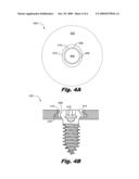 ROTOLOCK CERVICAL PLATE LOCKING MECHANISM diagram and image